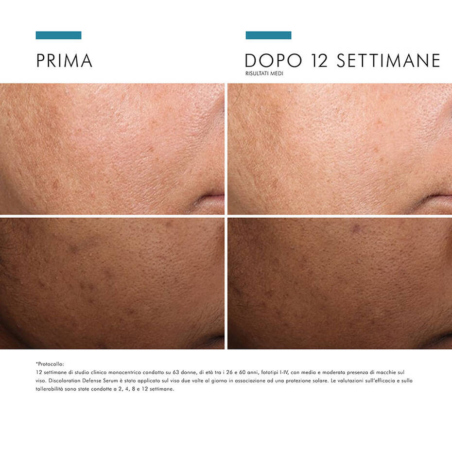 SKC-3606000481282-DISCOLORATION-DEFENSE-SERUM-7-940×940